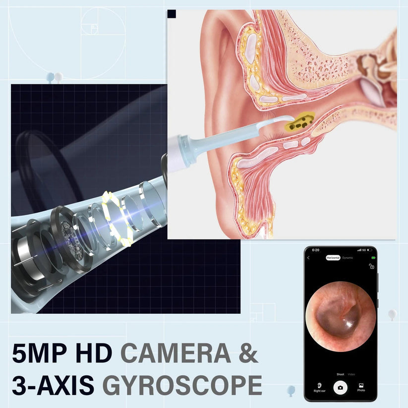 Smart Visual Ear Wax Cleaner