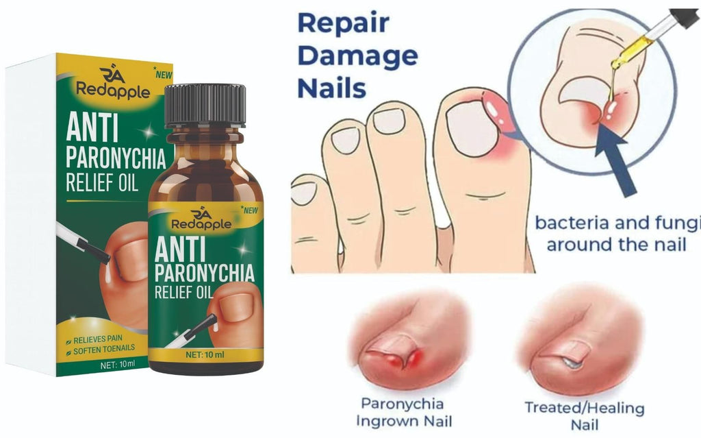Anti Paronychia Relief Oil 10 ml Pack of 2