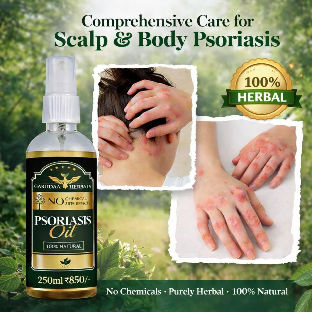 Garuda Herbal Psoriasis Oil