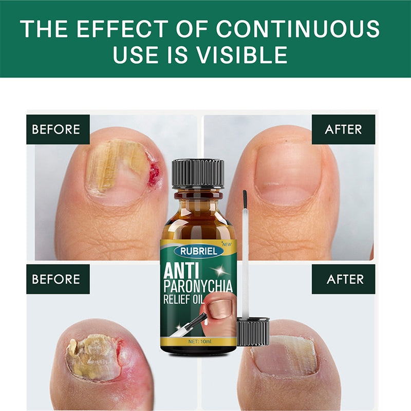 Anti Paronychia Relief Oil 10 ml Pack of 2